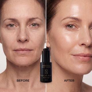 Before and after comparison showing skin appearance with Sagrada Bakuchiol Night Serum