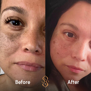 Side-by-side before and after of woman’s skin, showing improved texture and tone after using Sagrada BioSkincare